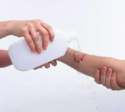 محلول شستشوی زخم